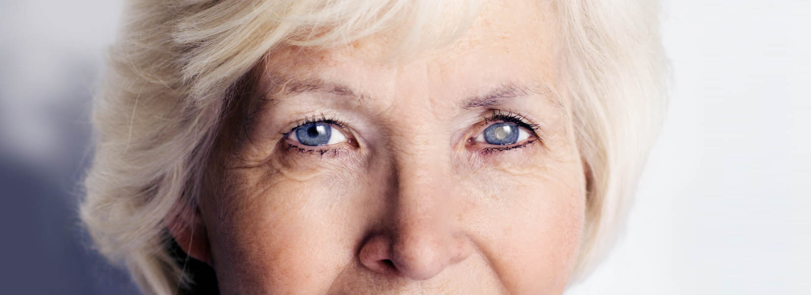 Cataract Surgery in Mesa